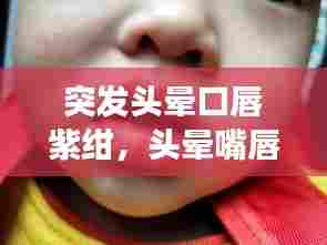 突发头晕口唇紫绀，头晕嘴唇发紫是怎么回事 