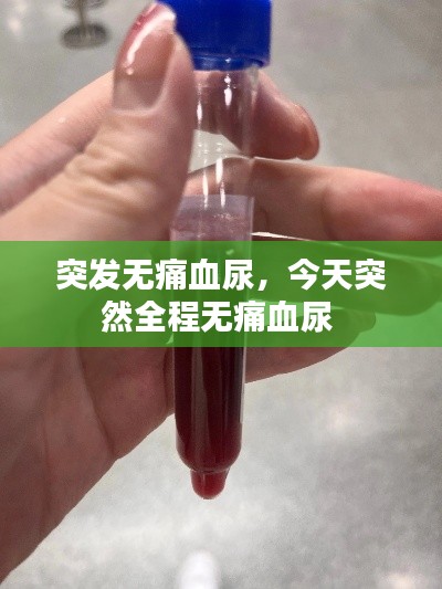 突发无痛血尿，今天突然全程无痛血尿 