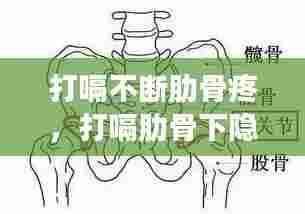 打嗝不断肋骨疼，打嗝肋骨下隐痛什么病 