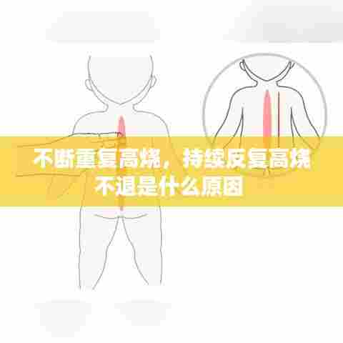 不断重复高烧，持续反复高烧不退是什么原因 