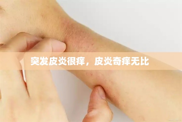 突发皮炎很痒，皮炎奇痒无比 
