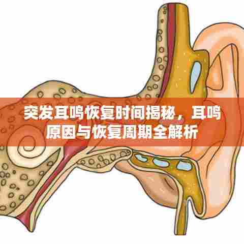 突发耳鸣恢复时间揭秘，耳鸣原因与恢复周期全解析