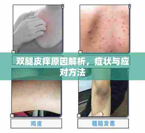 双腿皮痒原因解析，症状与应对方法