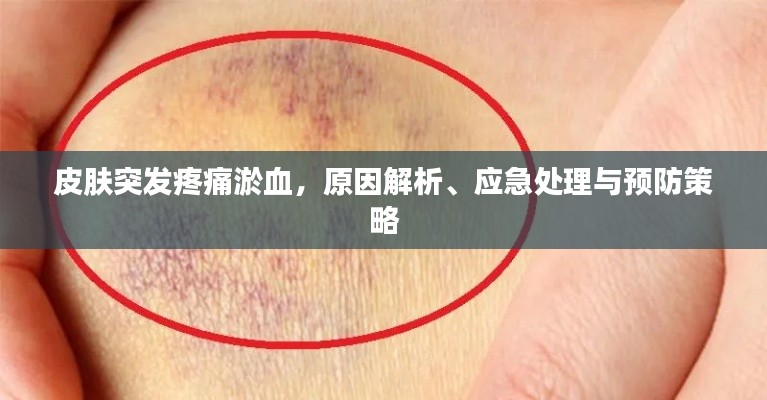 皮肤突发疼痛淤血，原因解析、应急处理与预防策略