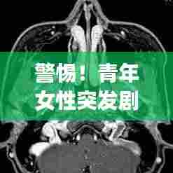 警惕！青年女性突发剧烈头疼，身体紧急信号不容忽视