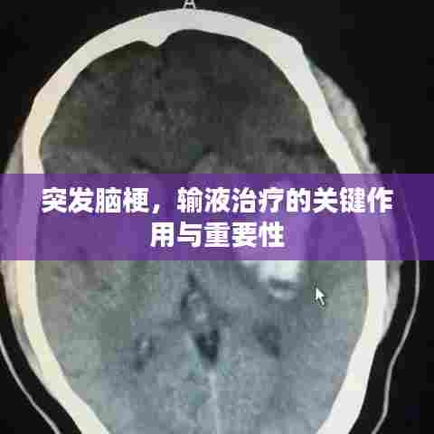 突发脑梗，输液治疗的关键作用与重要性