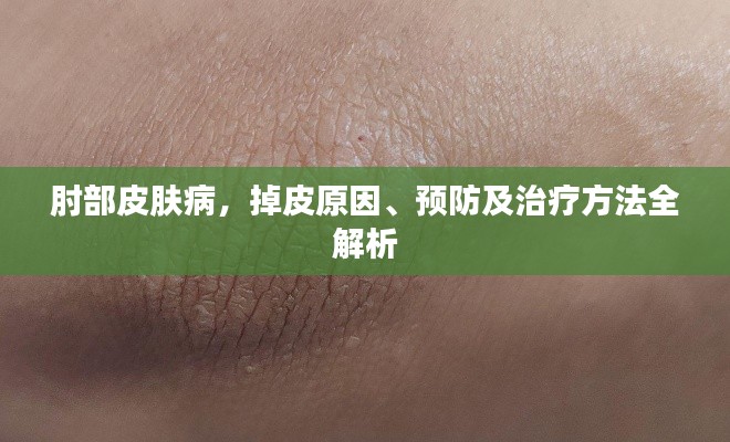 肘部皮肤病，掉皮原因、预防及治疗方法全解析